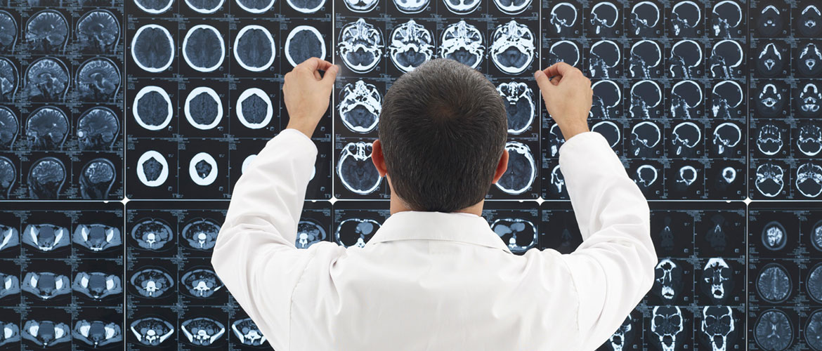 Traumatic Brain Injury - Law Offices of Parente & Norem